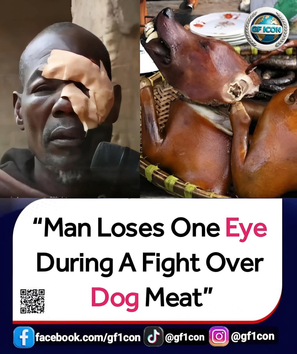 A father of six has suffered a severe eye injury, leaving him almost blind in one eye, following a violent clash in Nkawkaw over dog&nbsp;meat.